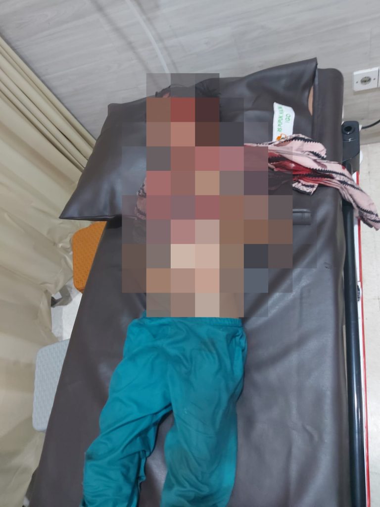 Berenang Saat Air Pasang, Bocah 12 Tahun Diterkam Buaya di Loktuan